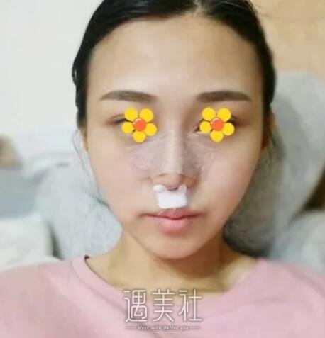上海韩镜赵越院长技术怎么样?有他的招牌手术案例吗?