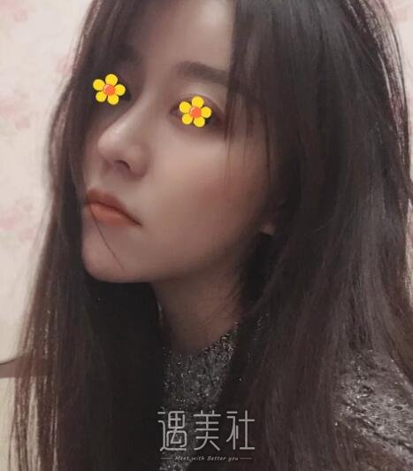 上海韩镜赵越院长技术怎么样?有他的招牌手术案例吗?