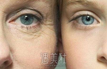 光子嫩肤时间多久做一次比较好?做一次果不明X吧?