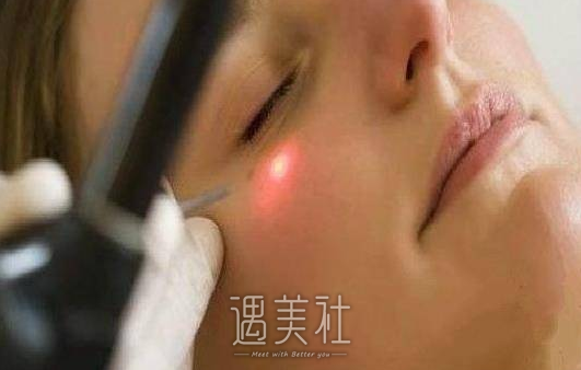 光子嫩肤时间多久做一次比较好?做一次果不明X吧?