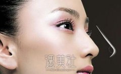 广州垫鼻子要多少钱?来看看费用受到哪些因素的影响~ width=