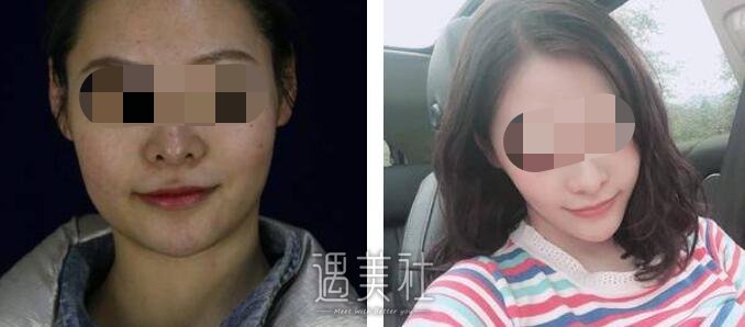 张笑天