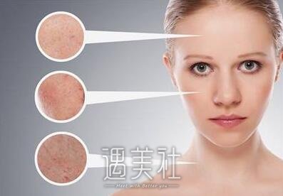 像素激光美容价格