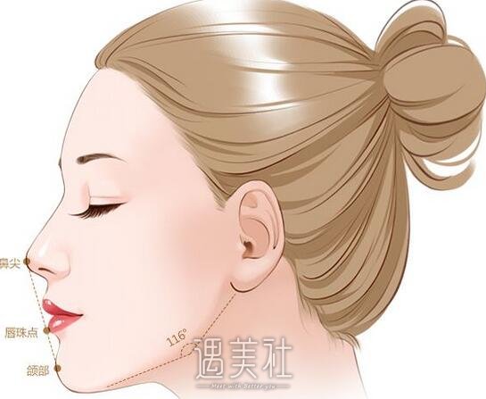 垫鼻子大概多少钱