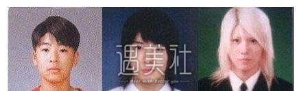 诺珉宇整容前后