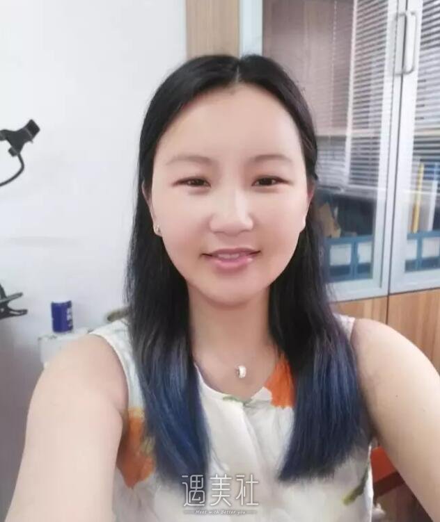 皮肤激光医生屈琳怎么样?有屈琳擅长项目真实案例吗?