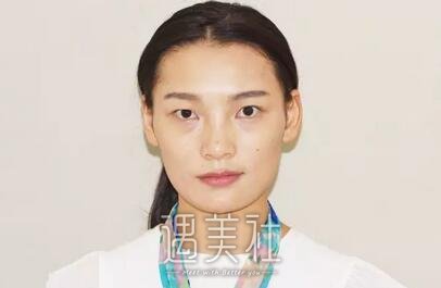 张姣姣,双眼皮