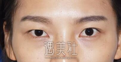 张姣姣,双眼皮
