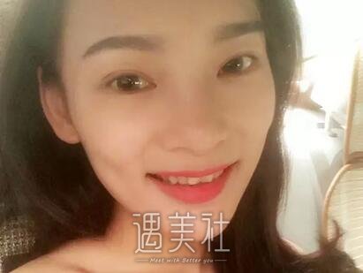 张姣姣,双眼皮
