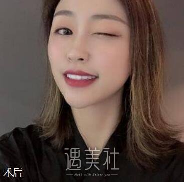 上海,金海兰,丰额头