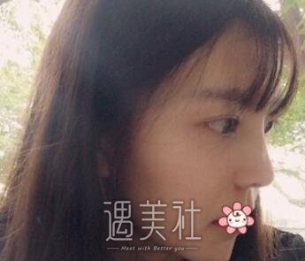 鼻部手术