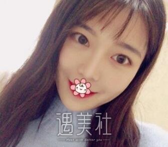 鼻部手术