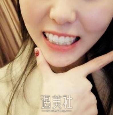 牙齿矫正
