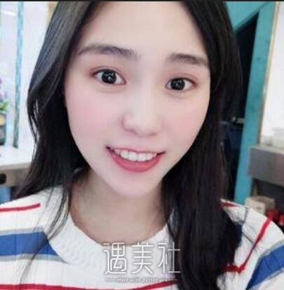 牙齿矫正