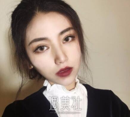 开内眼角