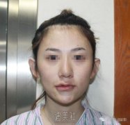 首尔丽格崔荣达面部不对称矫正案例：变美原来这么简单~ width=