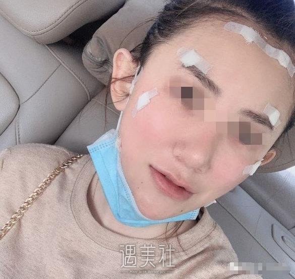 首尔丽格崔荣达面部不对称矫正案例：变美原来这么简单~