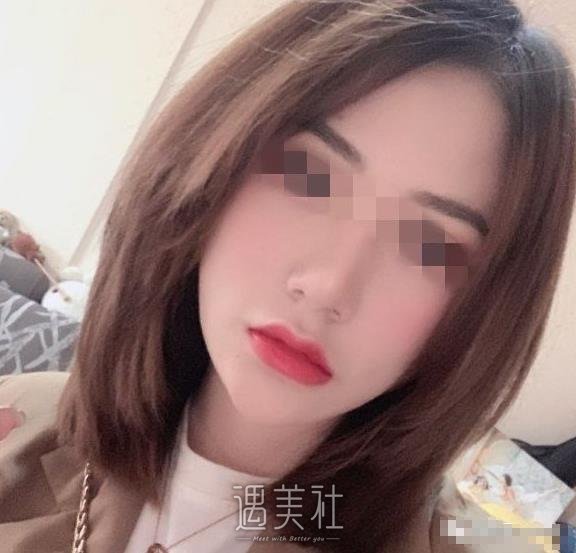 首尔丽格崔荣达面部不对称矫正案例：变美原来这么简单~