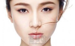 昆明垫鼻梁大概要多少钱?垫鼻梁乃塌鼻子朋友的福音啊~ width=