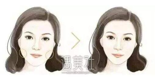 磨腮削骨