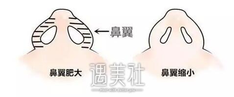 鼻孔大