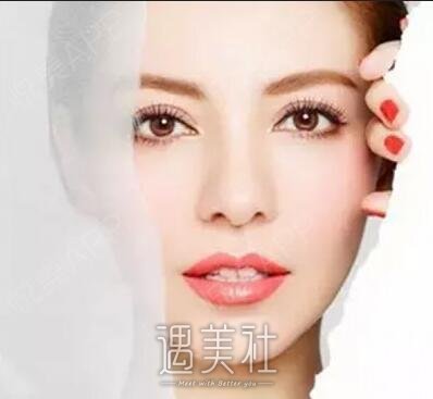 襄樊,面部吸脂修复