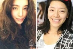 江映蓉整容前后照片纷纷曝光，这下网友心中也有一个数~ width=