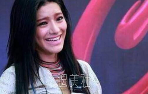 江映蓉整容