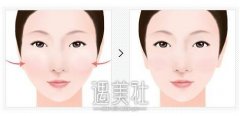 南医大改脸型大概多少钱?会比其他机构收费贵很多吗? width=