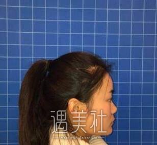 冯雁平