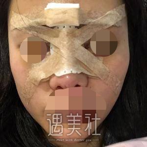 冯雁平