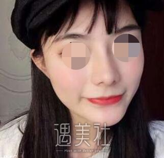 冯雁平