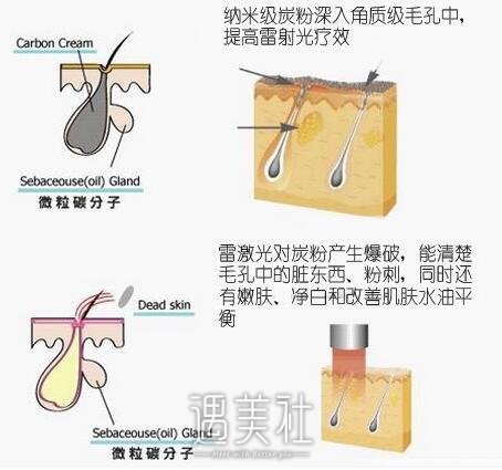 黑脸娃娃改良色素沉著