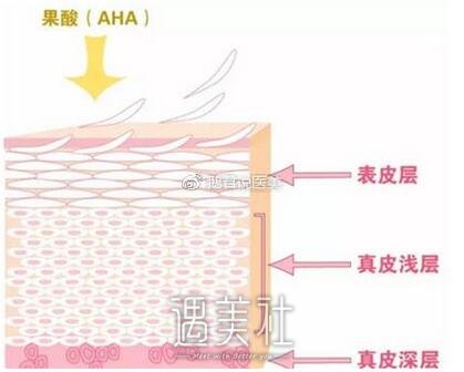 果酸换肤的果