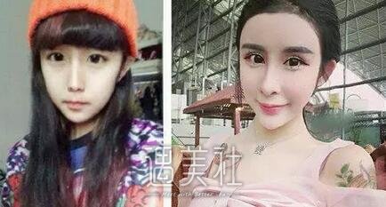 李蒽熙