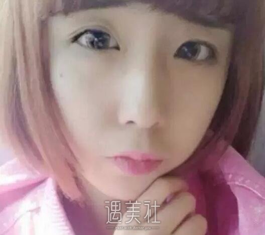 李蒽熙