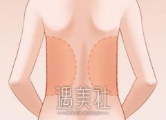 衡水水动力吸脂瘦身价格大概要多少钱？很多人都在做这个~ width=