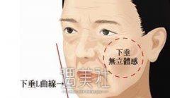 秦皇岛玻尿酸注射丰面颊大约需要多少钱？应该不会很贵吧？ width=