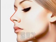 硅胶垫鼻梁大概能维持多少年？我想并不是“一劳永逸”吧？ width=