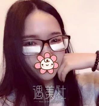 北京,卓彦,祛眼袋