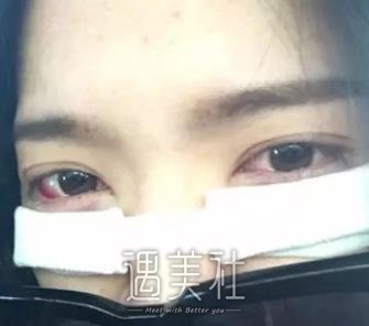 北京,卓彦,祛眼袋