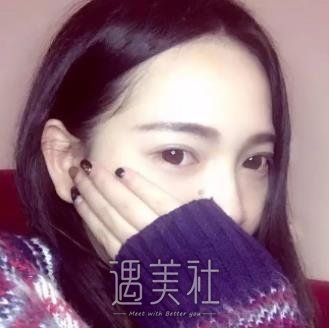 北京,卓彦,祛眼袋
