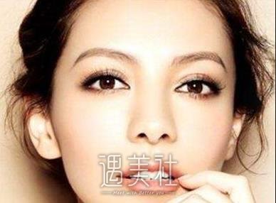 中山,生物焊接双眼皮