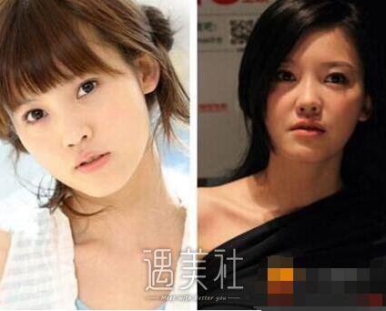 杨子珊整容前后照片再次曝光，网友惊叹自己女神之前这样的!