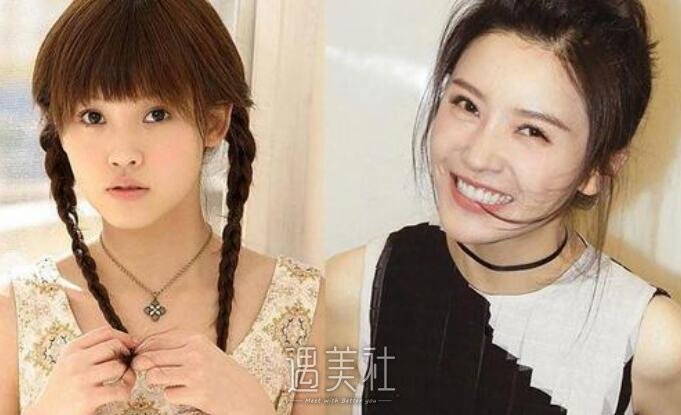 杨子珊整容前后照片再次曝光，网友惊叹自己女神之前这样的!