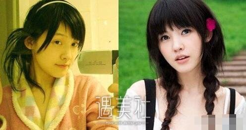 杨子珊整容前后照片再次曝光，网友惊叹自己女神之前这样的!