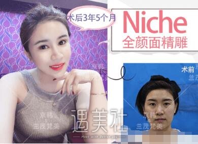 北京京韩乔爱军医生怎么样|乔爱军个人资料2019版更新啦~