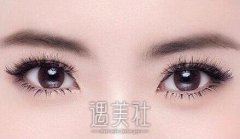泰安做微创生态双眼皮大约花费多少钱？啥区间比较合理呢？ width=