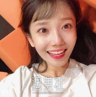 戴秀丽