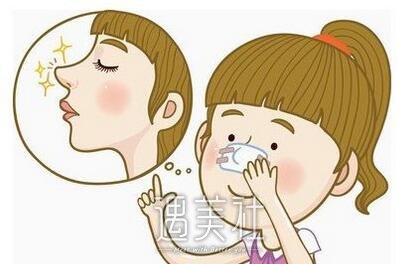 自体脂肪填充隆鼻